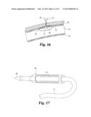 VASCULAR SUTURING DEVICE diagram and image