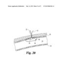 VASCULAR SUTURING DEVICE diagram and image