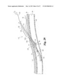 VASCULAR SUTURING DEVICE diagram and image