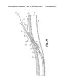 VASCULAR SUTURING DEVICE diagram and image