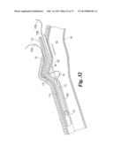 VASCULAR SUTURING DEVICE diagram and image