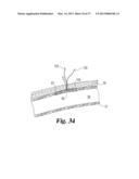 VASCULAR SUTURING DEVICE diagram and image