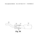 VASCULAR SUTURING DEVICE diagram and image