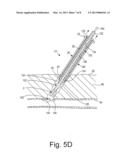 APPARATUS AND METHODS FOR SEALING A VASCULAR PUNCTURE diagram and image