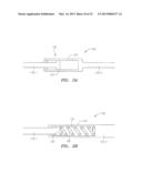 Systems, Devices and Methods for the Correction of Spinal Deformities diagram and image