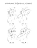 Systems, Devices and Methods for the Correction of Spinal Deformities diagram and image