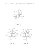 Systems, Devices and Methods for the Correction of Spinal Deformities diagram and image