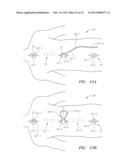 Systems, Devices and Methods for the Correction of Spinal Deformities diagram and image