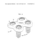 BONE SCREW RETAINING SYSTEM diagram and image