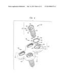 BONE SCREW RETAINING SYSTEM diagram and image