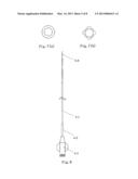 SURGICAL APPARATUS FOR ANEURYSMS diagram and image