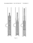 SURGICAL APPARATUS FOR ANEURYSMS diagram and image