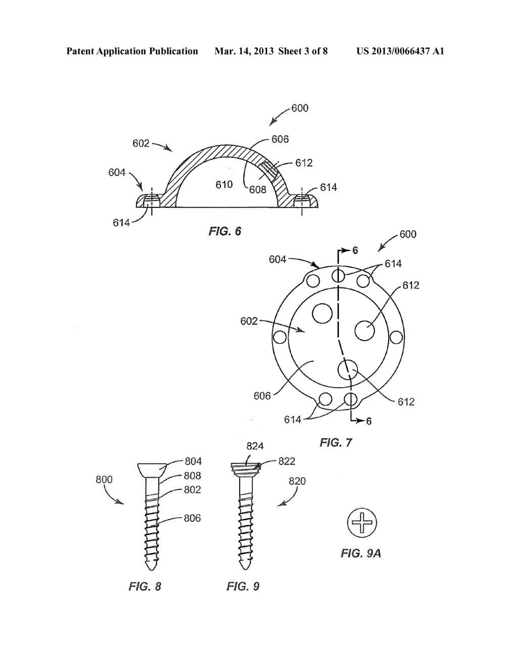 REVISION HIP IMPLANTS AND PROSTHESIS SYSTEMS - diagram, schematic, and image 04