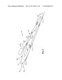 PROSTHETIC FOOT diagram and image