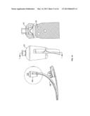 PROSTHETIC FOOT diagram and image