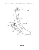 PROSTHETIC FOOT diagram and image