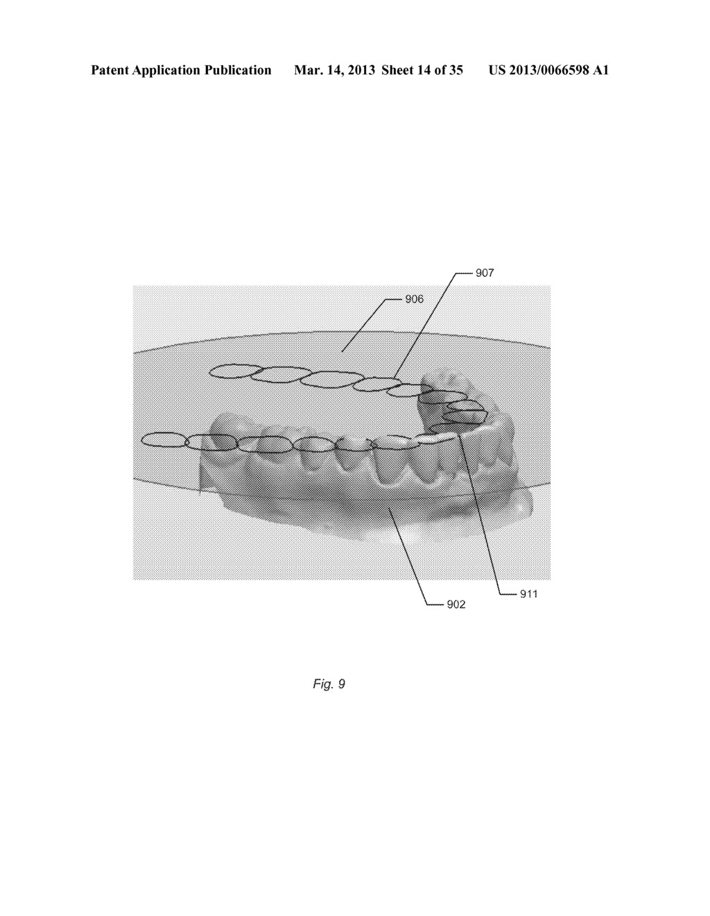 DYNAMIC VIRTUAL ARTICULATOR - diagram, schematic, and image 15