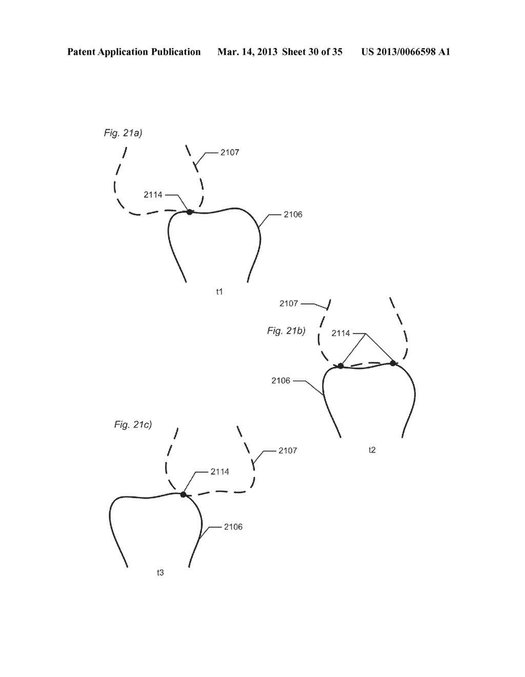 DYNAMIC VIRTUAL ARTICULATOR - diagram, schematic, and image 31