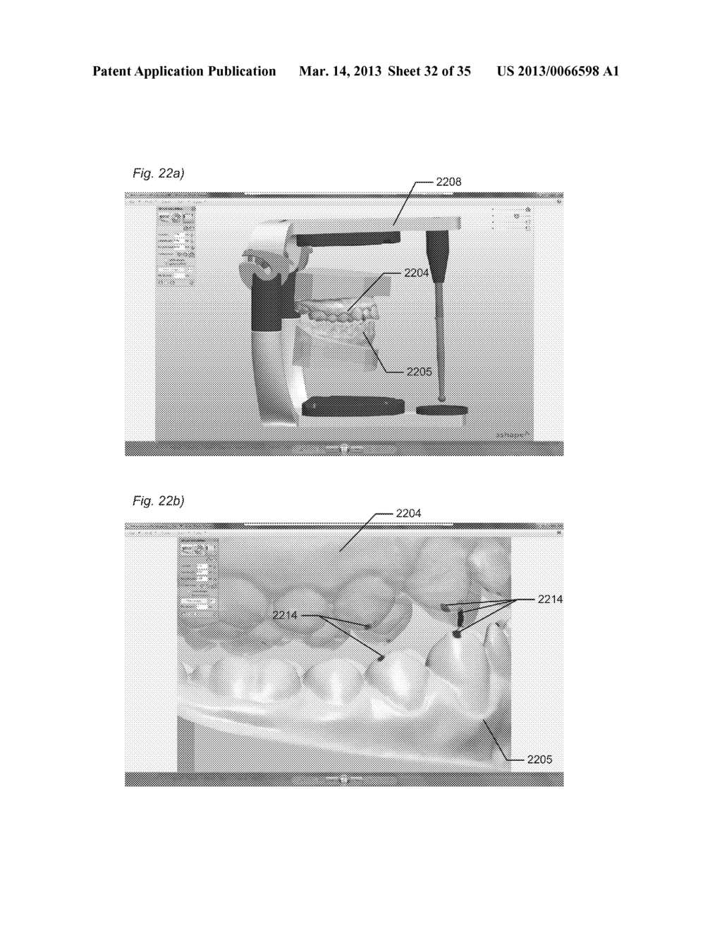 DYNAMIC VIRTUAL ARTICULATOR - diagram, schematic, and image 33