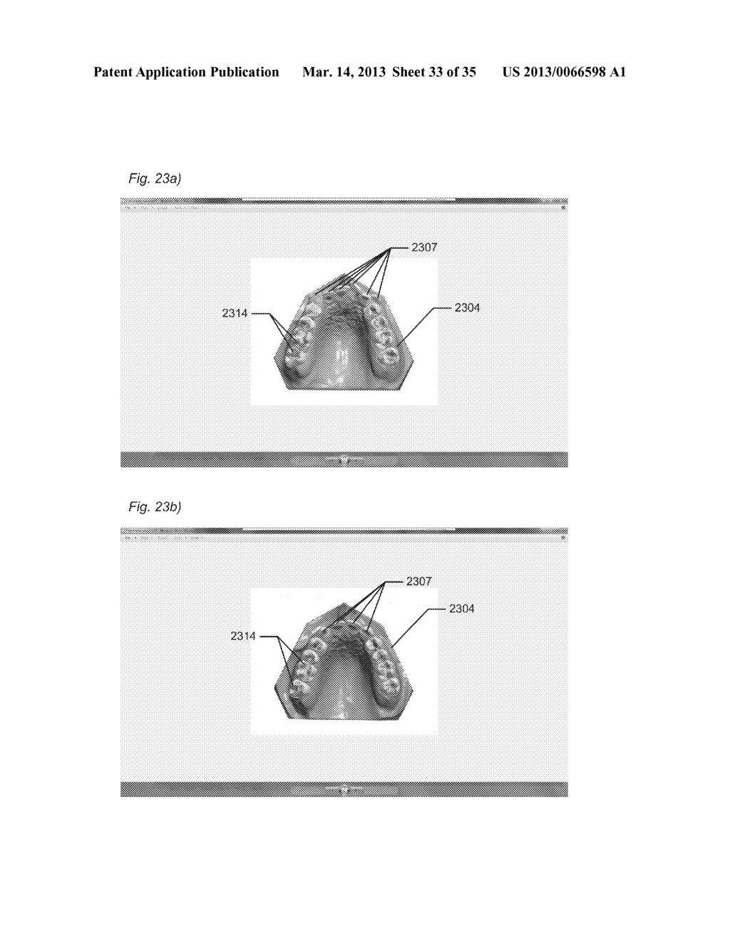 DYNAMIC VIRTUAL ARTICULATOR - diagram, schematic, and image 34