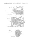 REMOVABLE ROUNDED MIDSOLE STRUCTURES AND CHAMBERS WITH COMPUTER     PROCESSOR-CONTROLLED VARIABLE PRESSURE diagram and image