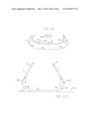 REMOVABLE ROUNDED MIDSOLE STRUCTURES AND CHAMBERS WITH COMPUTER     PROCESSOR-CONTROLLED VARIABLE PRESSURE diagram and image