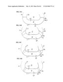 REMOVABLE ROUNDED MIDSOLE STRUCTURES AND CHAMBERS WITH COMPUTER     PROCESSOR-CONTROLLED VARIABLE PRESSURE diagram and image