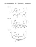 REMOVABLE ROUNDED MIDSOLE STRUCTURES AND CHAMBERS WITH COMPUTER     PROCESSOR-CONTROLLED VARIABLE PRESSURE diagram and image