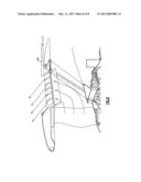 FAN CASE THRUST REVERSER diagram and image