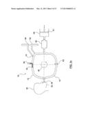 ANESTHETIC CIRCUIT AND A METHOD FOR USING THE ANESTHETIC CIRCUIT diagram and image