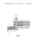 Structure Containing Wound Treatment Material diagram and image