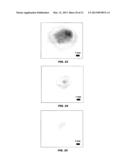 APPARATUS AND METHOD FOR SURFACE AND SUBSURFACE TACTILE SENSATION IMAGING diagram and image