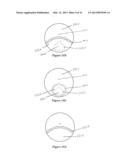 MULTIFOCAL LENS HAVING A PROGRESSIVE OPTICAL POWER REGION AND A     DISCONTINUITY diagram and image