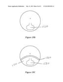 MULTIFOCAL LENS HAVING A PROGRESSIVE OPTICAL POWER REGION AND A     DISCONTINUITY diagram and image