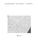 MEDICAL TREATMENT APPLICATIONS OF SWELLABLE AND DEFORMABLE MICROSPHERES diagram and image