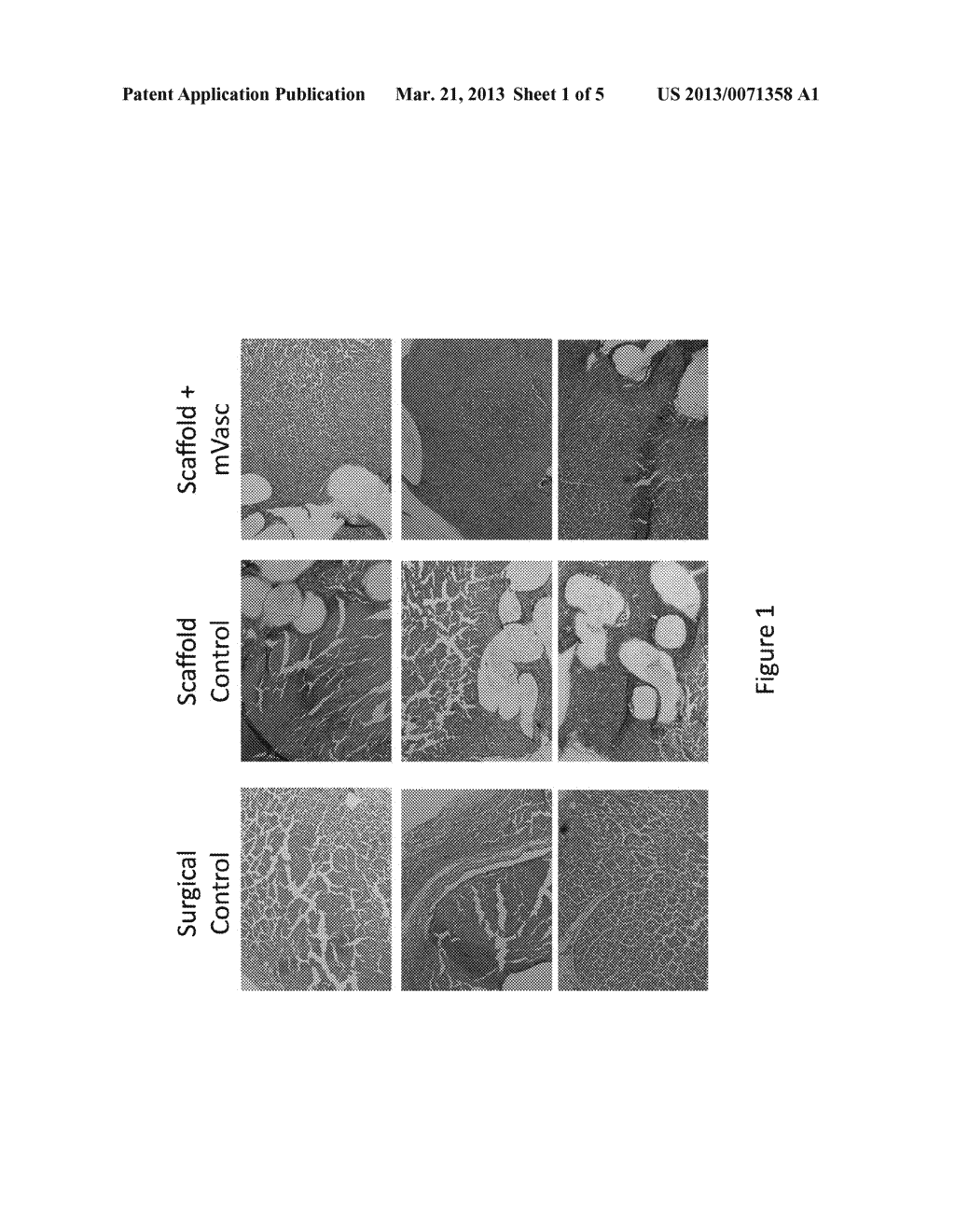 ALLOGENEIC MICROVASCULAR TISSUE FOR SOFT TISSUE TREATMENTS - diagram, schematic, and image 02