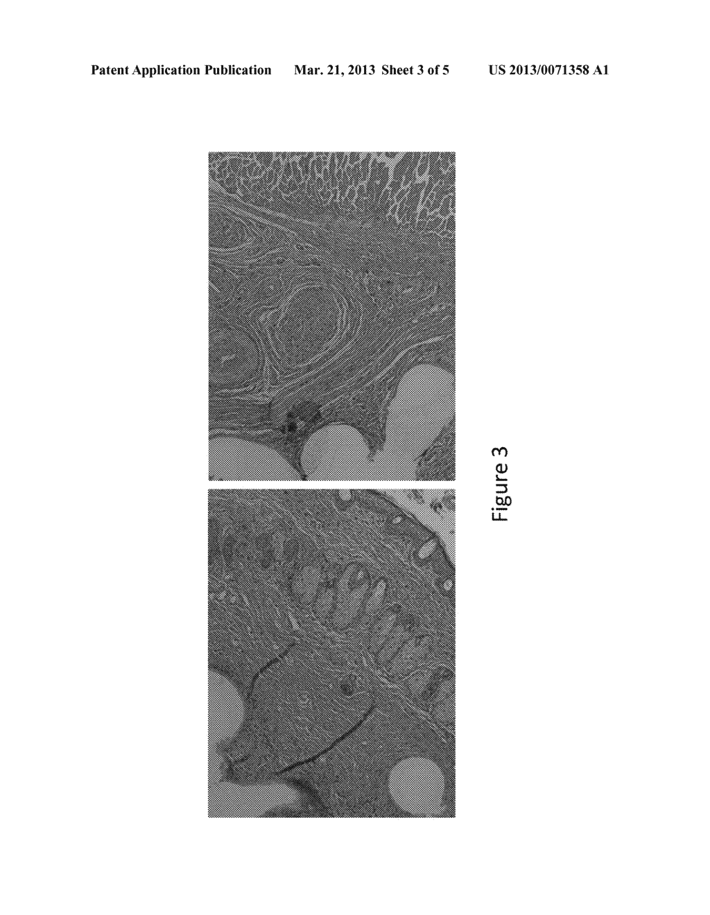 ALLOGENEIC MICROVASCULAR TISSUE FOR SOFT TISSUE TREATMENTS - diagram, schematic, and image 04