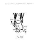 INHIBITORS OF VASCULAR ENDOTHELIAL GROWTH FACTOR (VEGF) RECEPTORS AND     METHODS OF USE THEREOF diagram and image