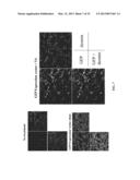 RETINOID-LIPOSOMES FOR TREATING FIBROSIS diagram and image