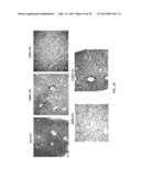 RETINOID-LIPOSOMES FOR TREATING FIBROSIS diagram and image