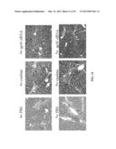 RETINOID-LIPOSOMES FOR TREATING FIBROSIS diagram and image