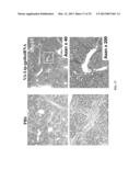 RETINOID-LIPOSOMES FOR TREATING FIBROSIS diagram and image