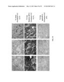 RETINOID-LIPOSOMES FOR TREATING FIBROSIS diagram and image