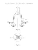 CENTRIFUGAL SEPARATOR diagram and image