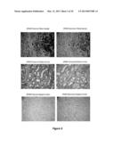 THERANOSTIC AND DIAGNOSTIC METHODS USING SPARC AND HSP90 diagram and image