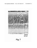 METHODS FOR THE TREATMENT AND PREVENTION OF AGE-RELATED RETINAL     DYSFUNCTION diagram and image