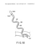 RIGID ENDOSCOPE diagram and image