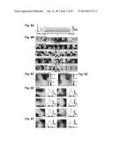 Conformable Actively Multiplexed High-Density Surface Electrode Array for     Brain Interfacing diagram and image