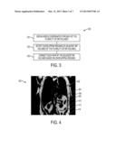 SYSTEM AND METHOD FOR AUTOMATIC MAGNETIC RESONANCE VOLUME COMPOSITION AND     NORMALIZATION diagram and image