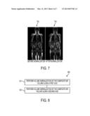 SYSTEM AND METHOD FOR AUTOMATIC MAGNETIC RESONANCE VOLUME COMPOSITION AND     NORMALIZATION diagram and image